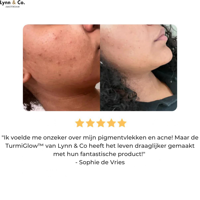 TurmiGlow™ - Gouden Kurkuma Zeep